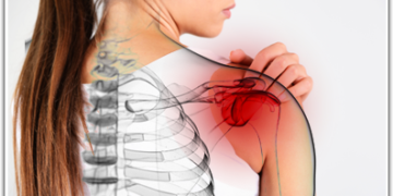 Physiotherapy Management for Frozen Shoulder